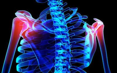 Diseases & Conditions – Shoulder