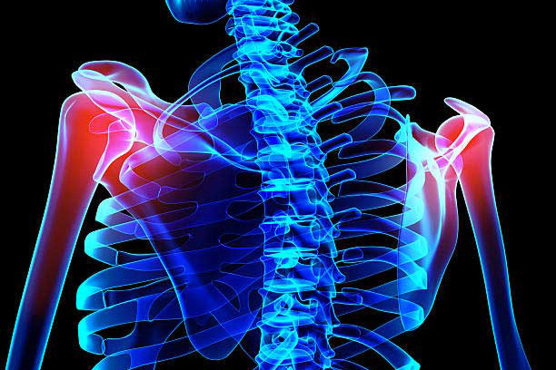 Diseases & Conditions – Shoulder
